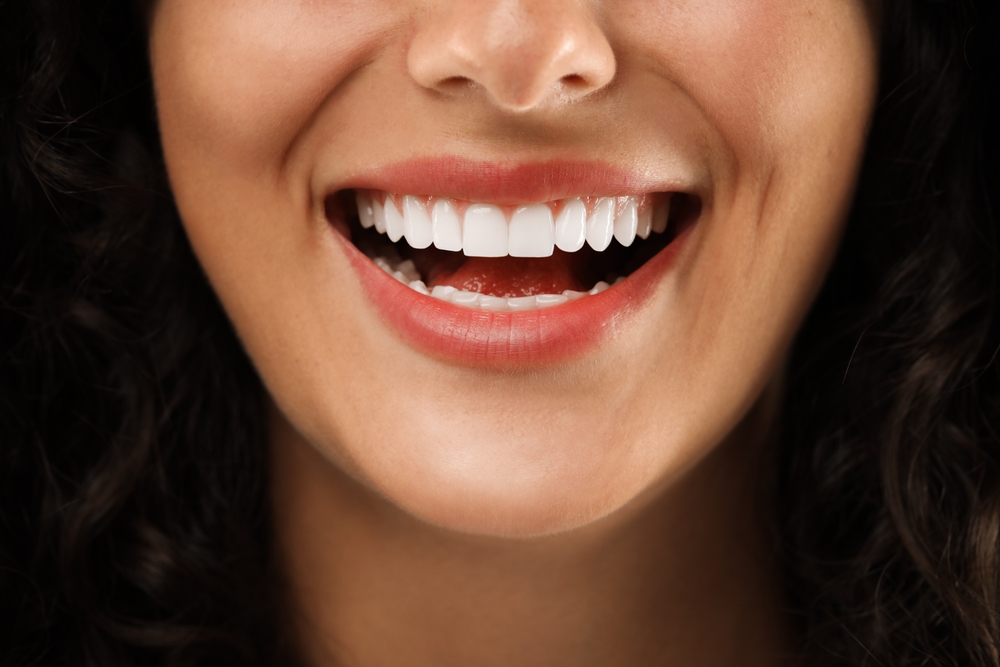 teeth whitening oklahoma city