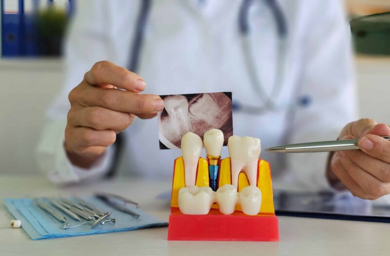 dental implants oklahoma city